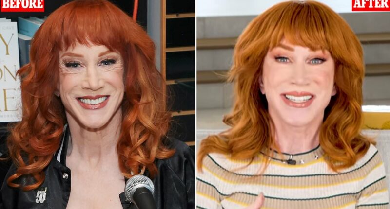 Kathy Griffin confirms she underwent THIRD face lift