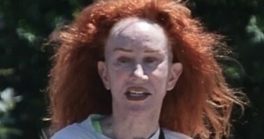 Kathy Griffin's new facelift REVEALED