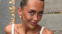 Love Island's Jess White responds to plastic surgery claims