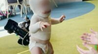 Baby Luka has undergone eight surgeries since the burning coffee was thrown on him.