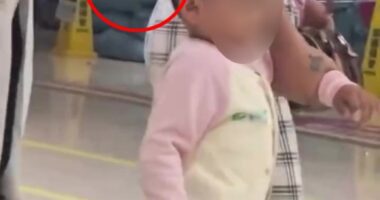 Toddler with knife in head arriving at hospital.