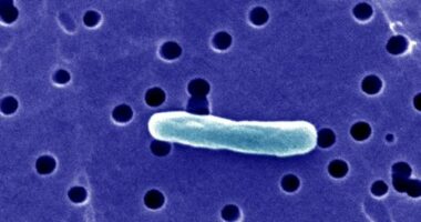 Twenty-one patients in Florida have become ill — some with E. coli — after consuming raw milk, according to a warning from the Florida Department of Health.