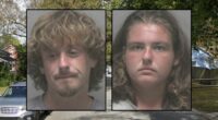 Parents of 2-month-old with fractured skull arrested: Police