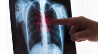 Surgeon warns of killer complication linked to weight loss jabs