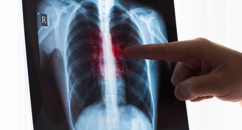 Surgeon warns of killer complication linked to weight loss jabs