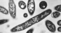 Legionnaires' disease