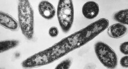 Legionnaires' disease