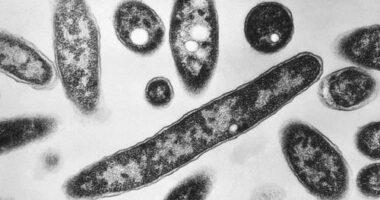 Legionnaires' disease