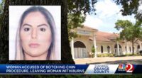 Unlicensed laser procedure burned woman's chin: Police