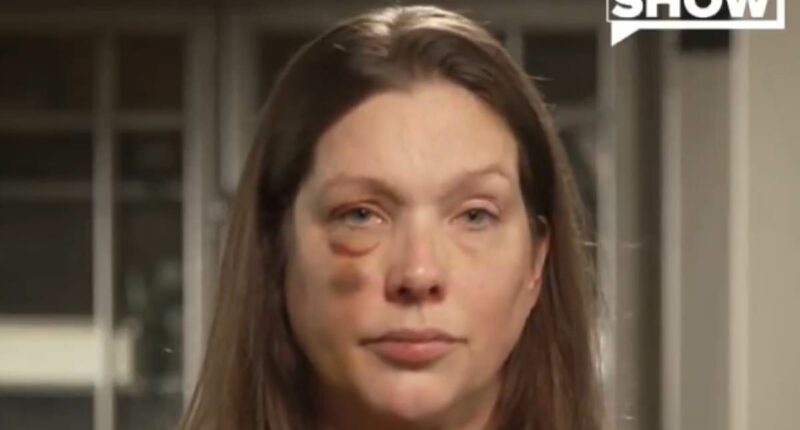 Woman beaten in Cincinnati brawl says officials have ignored her