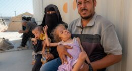 British nurse in Gaza shares reality of malnutrition on the frontlines as brave medics battle shortages to treat patients