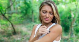 Doctor says there's new 'very real threat' of 'fatal' insect bites in UK