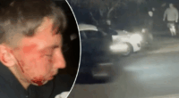 Emergency surgery for teen after bizarre Perth glass attack