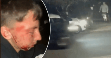 Emergency surgery for teen after bizarre Perth glass attack