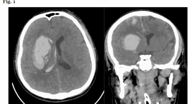 Fresh warning over killer fungal infection dubbed 'threat to humanity' - medics desperately hunt for a cure