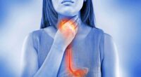 How to heal heartburn WITHOUT drugs: Acid reflux pills taken by millions cause crippling side-effects and are even linked to cancer and dementia. Now doctors reveal what to do