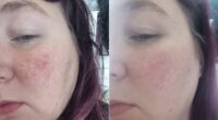 I tried cream that promised to reduce redness — it actually did something else