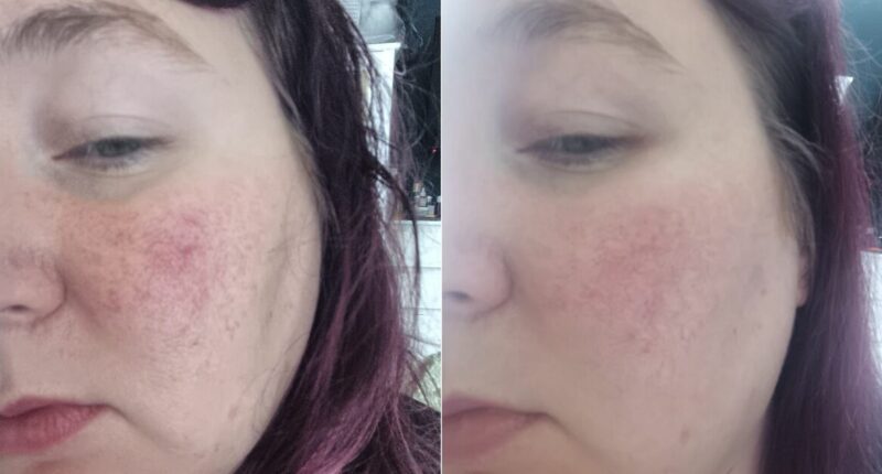 I tried cream that promised to reduce redness — it actually did something else