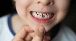I’m a dentist – never ignore these symptoms in children