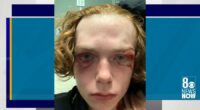 Las Vegas mom sues teenagers after son's beating; says juvenile justice system failed