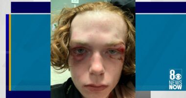 Las Vegas mom sues teenagers after son's beating; says juvenile justice system failed