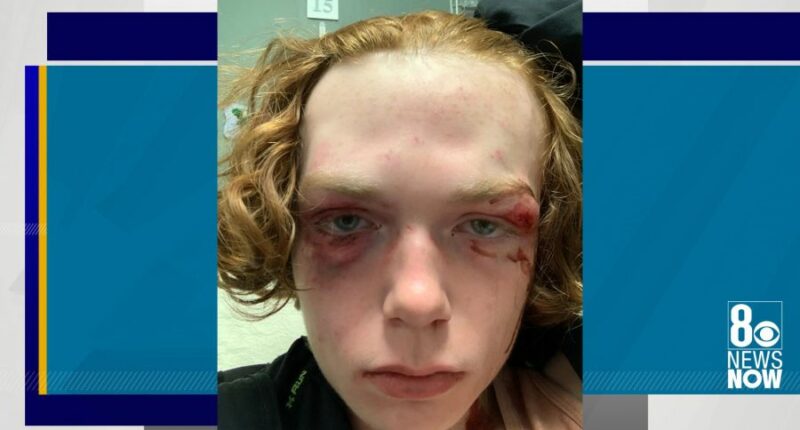 Las Vegas mom sues teenagers after son's beating; says juvenile justice system failed