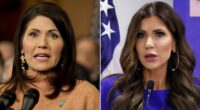 Plastic surgeons reveal what could be behind ICE Barbie Kristi Noem's changing face