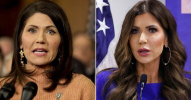 Plastic surgeons reveal what could be behind ICE Barbie Kristi Noem's changing face