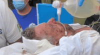 Stung 500 times by 'killer bees', Utah dad needs help recovering