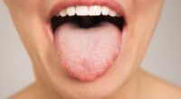 Why does my tongue keep tingling? It could be harmless. But it could also be lethal. Doctors reveal the subtle symptom differences