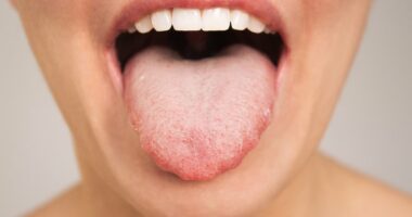 Why does my tongue keep tingling? It could be harmless. But it could also be lethal. Doctors reveal the subtle symptom differences