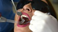 'I'm a dentist and I can tell 7 things about your health before you say a word'