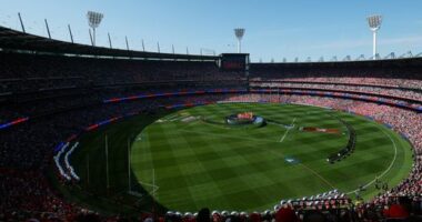 MCG