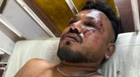 Air India survivor may never return to UK because he is scared to fly