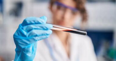 Breakthrough test could spot deadly motor neurone disease years before symptoms appear