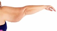 Can you REALLY lose weight on Mounjaro and avoid loose skin? We asked the experts - and their responses will horrify you