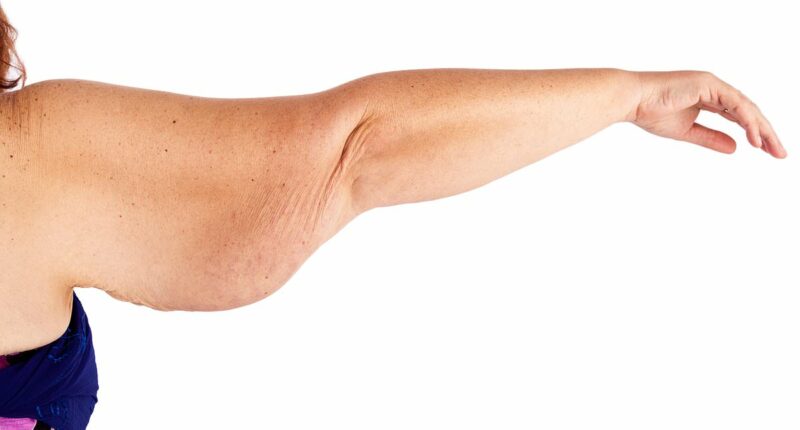 Can you REALLY lose weight on Mounjaro and avoid loose skin? We asked the experts - and their responses will horrify you