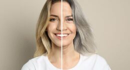 Chinese scientists claim they can cure grey hair with scalp injections