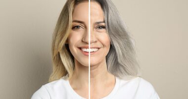 Chinese scientists claim they can cure grey hair with scalp injections