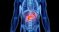 Dirty habit puts millions at risk of hidden pancreatic cancer - doctors call for screening as cases soar