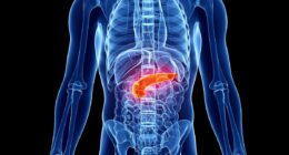 Dirty habit puts millions at risk of hidden pancreatic cancer - doctors call for screening as cases soar