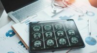 Disease with 'hard to spot' symptoms that can cause dementia