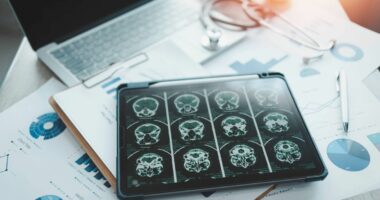 Disease with 'hard to spot' symptoms that can cause dementia