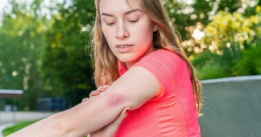 Don't get bitten again... 7 ways to stop insects without heavy-duty chemicals