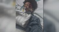 Family of metro Atlanta boy hurt in deadly ATV crash questions safety at park