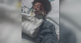 Family of metro Atlanta boy hurt in deadly ATV crash questions safety at park