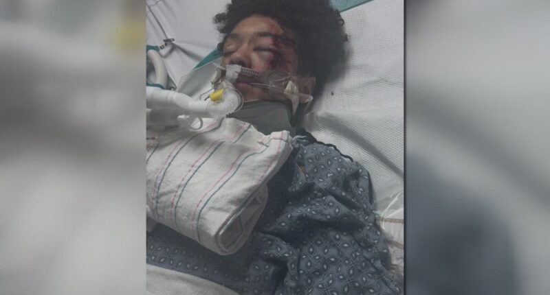 Family of metro Atlanta boy hurt in deadly ATV crash questions safety at park