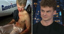 Former DOGE staffer Edward Coristine describes brutal DC attack by teen gang