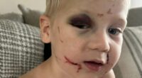 Fury as daycare worker who 'battered one-year-old boy' is released