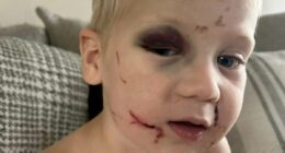 Fury as daycare worker who 'battered one-year-old boy' is released